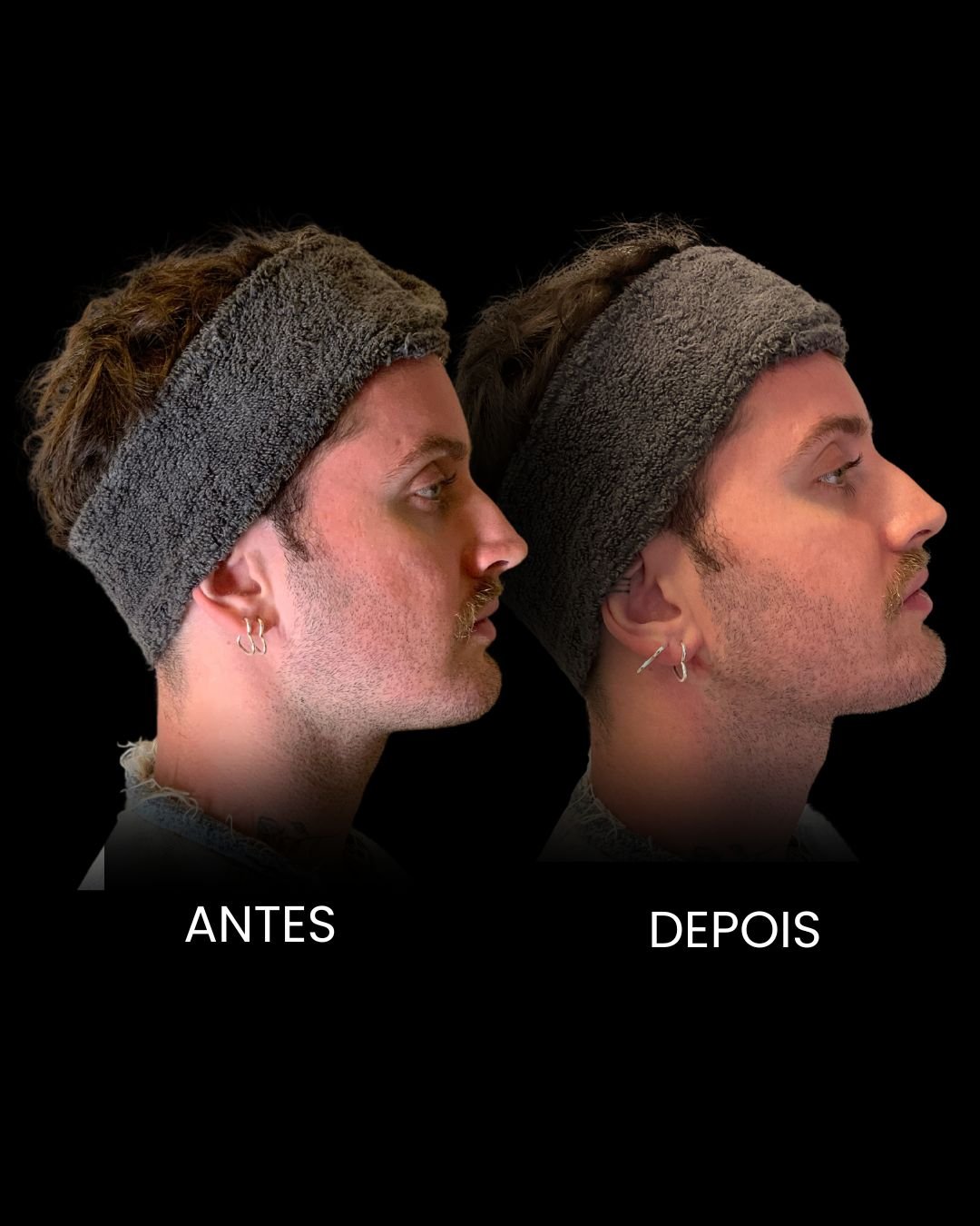 VETOR PAPADA